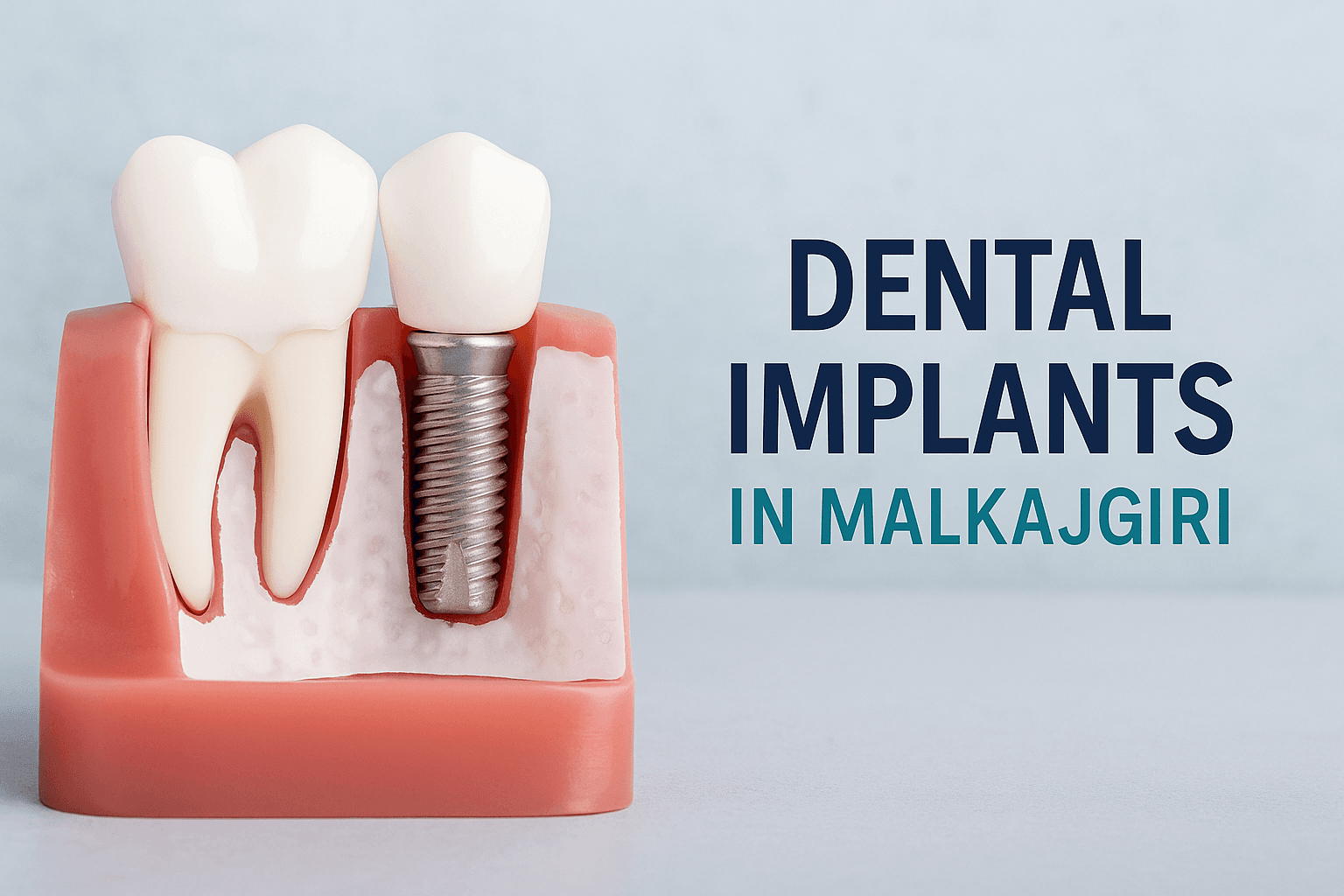 Restore Your Smile with Dental Implants in Malkajgiri