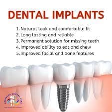Restore Your Smile with Dental Implants in Malkajgiri